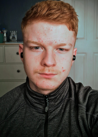 owen